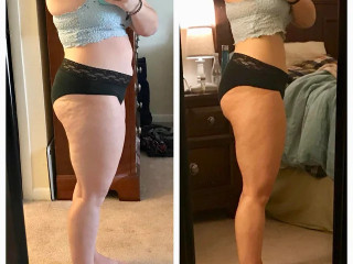 mounjaroozempic-ve-sleve